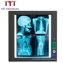 Medical LED Negatoscope Single X-Ray Film Scanner